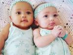Wow! Bayi Lahir Dengan Warna Kulit Beda. Ternyata Ini Penyebabnya