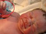Mengejutkan, Seorang Bayi Lahir dengan Menggenggam Alat Kontrasepsi. Ternyata Ini yang Terjadi
