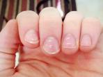 Bukan Sedang ditaksir Seseorang, Ini Fakta Mencengangkan di Balik Munculnya Garis Putih Pada Kuku!