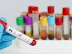 Waspada & Jangan Diabaikan, Inillah Tanda-tanda Jika Salah Satu Diantara Kita Terserang Virus HIV