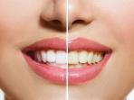 Begini Cara Miliki Gigi Putih dengan Racikan Kunyit