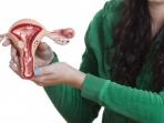 Bisa Mempengaruhi Kesuburan Wanita, Kenali Gejala dan Penyebab Kista Endometriosis