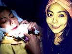 Mirip Sariawan, Waspadai Gejala Awal Kanker Lidah yang Telah Merenggut Nyawa Artis FTV Cecillia Putty 