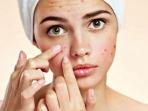 4 Bahan Alami yang Ampuh Hilangkan Bekas Jerawat