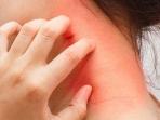 Waspadai 4 Gejala Awal Organ Liver Anda Bermasalah, Cek Sekarang Juga!