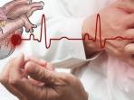 Cek Kelainan Jantung dari Kondisi Kulit, Begini Caranya