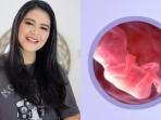 Kahiyang Ayu Dikabarkan Hamil, Berikut Tanda-tanda Awal Wanita yang Sedang Berbadan Dua