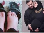 Ternyata Ini Penyebab Kaki Bengkak Saat Hamil yang Seperti Dirasakan Siti Nurhaliza