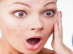 Bukan Faktor Kebetulan, Letak Jerawat Bisa Tunjukkan Masalah Kesehatan Lain dari Organ Tubuh Kita