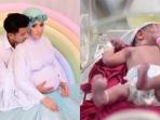  Putri Fairuz A Rafiq Disunat Saat Masih Bayi, Menurut Medis Ini Bahaya Sunat Perempuan