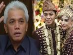 Adara Taista Meninggal Karena Kanker Kulit, Kenali Gejala Penyakit yang Diderita Mantu Hatta Rajasa Ini