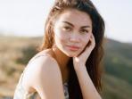 Dibalik Paras Cantik Ariel Tatum, Ada Bagian Tubuh yang Tak Sempurna. Fotonya Bikin Ngilu!