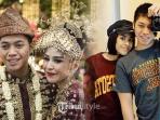 Meninggal Karena Kanker Kulit, Begini Kronologi Sakitnya Adara Taista Menantu dari Hatta Rajasa