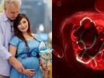 Ini Bahaya Pengentalan Darah Seperti yang Dialami Baby Margaretha Saat Hamil Anak Pertama