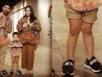 Ini Penyebab Bentuk Kaki Tak Normal Seperti yang Dialami Rafathar