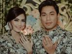 Kenalin Monica Imas, Si Cantik Calon Istri Rizal Armada yang Juga Jadi Vokalis Band