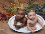 Terlahir Sebagai Saudara Kembar, 2 Bayi Ini Memiliki Warna Kulit yang Berbeda