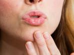 4 Kebiasaan Sepel yang Membuat Bibir Kering dan Pecah-pecah