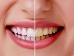 Bikin Tak Percaya Diri, Ini 5 Bahan Alami untuk Putihkan Gigi yang Mulai Menguning