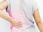 Ini Kebiasaan Sepele yang Membuat Bentuk Tulang Belakang Tak Normal