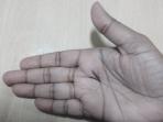 Tak Hanya Simbol X, Bentuk Garis V di Telapak Tangan Juga Tanda Nasib Hidup yang Baik. Ini Alasannya