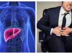 Wajib untuk Diketahui, Ini Beberapa Gejala Hepatitis A yang Tak Terduga & Bisa Menjangkit Siapa Saja