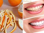 Begini Cara Mudah Putihkan Gigi dengan Kulit Jeruk