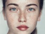 Bukan Trend Makeup Kekinian, Ini 4 Penyebab Muncul Bintik Hitam Pada Wajah