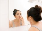Jerawat Selalu Muncul di Tempat yang Sama? Coba Atasi dengan Cara Mudah Ini