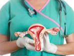 Sama-sama Menyerang Sistem Reproduksi Wanita, Ini Beda Kista dan Miom yang Wajib Diwaspadai