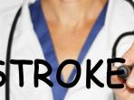 Waspadalah! Cek Apakah Anda Mengalami Gejala Awal Penyakit Stroke dengan Cara Mudah Ini