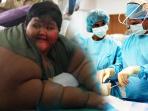 Mengenal Metode dan Efek Samping Operasi Bariatrik yang Bantu Arya Permana Turunkan Berat Badan Hingga 100 Kg
