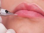 Pertimbangkan 3 Hal Ini Sebelum Lakukan Sulam Bibir