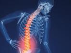 3 Makanan Terbaik Ampuh Lawan Osteoporosis, Konsumsi Sekarang Juga!