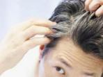 Bukan dengan Dicat, Ini 5 Tips Bermanfaat Atasi Masalah Rambut Beruban pada Kaum Muda