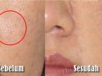 Tak Perlu ke Klinik Skin Care, Begini Cara Praktis Menutup Pori-pori Besar di Wajah