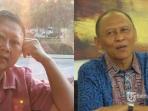 Dapat Donor Sumsum Tulang Belakang dari Sang Adik, Seperti Ini Prosedur Transplantasi yang Akan Dijalani Ani Yudhoyono