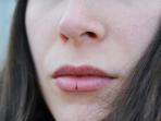 Tanpa Disadari, Ini 5 Kebiasaan Sepele Penyebab Bibir Kering