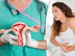 Waspadai Penyebab Kanker Serviks pada Wanita Usia Muda yang Sering Disepelekan