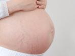 Cara Mudah Cegah Munculnya Stretch Mark Pada Ibu Hamil