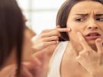 Tips Cara Ampuh Hilangkan Jerawat Dengan Bahan Alami