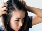 4 Penyebab Timbulnya Jerawat pada Kulit Kepala atau Dalam Tumpukan Rambut