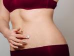 Punya Masalah Stretch Mark? Begini Cara Mengatasinya dengan Minyak Kelapa