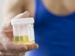 Deteksi Dini Gangguan Kesehatan Serius dari Kondisi Urin
