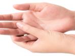 Tips Obati Cedera Jari Tangan Agar Tak Makin Parah