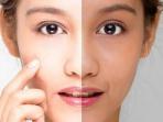 Intip Yuk, Berikut Tips Jitu Atasi Kulit Belang yang Wajib Dicoba