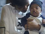 Mengenal Sindrom Williams, Penyakit Langka yang Diderita Anak Komedian Dede Sunandar
