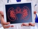Bisa Bersihkan Ginjal Secara Alami, Ini Deretan Minuman yang Bisa Anda Konsumsi