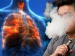 Mirip Flu, Waspadai Gejala EVALI, Penyakit Paru Misterius Akibat Rokok Elektrik