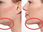 5 Bahan Alami yang Ampuh Hilangkan Lemak Dagu dalam 6 Hari, Buktikan!